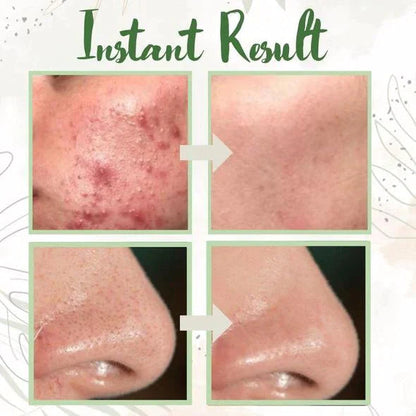 Silvarael® Green Tea Pore Reset Mask Stick