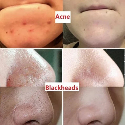 Aroxens  Green Tea Deep Cleanse Mask Stick